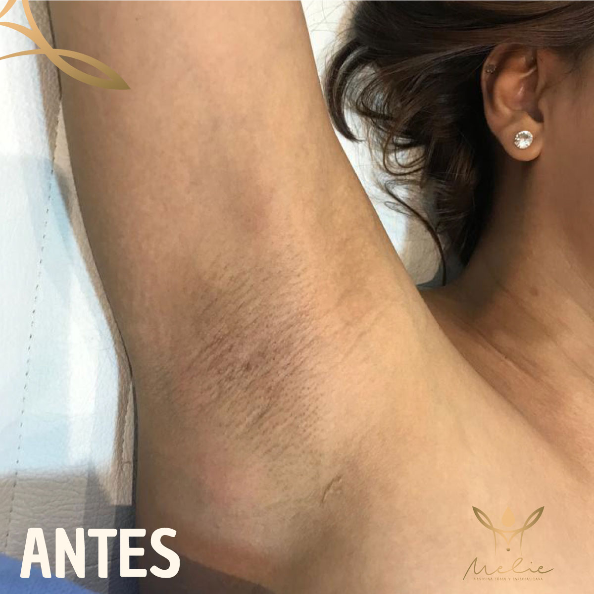 antes