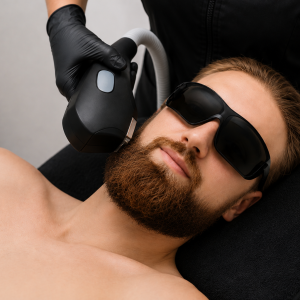 DEPILACIÓN LASER PERFILAMIENTO BARBA - 1